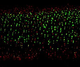 A microscopic image section of cartilage showing live and dead cells with stained dye.