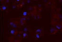 microscopic of murine pancreatic beta cells