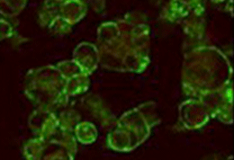 microscopic of murine pancreatic beta cells