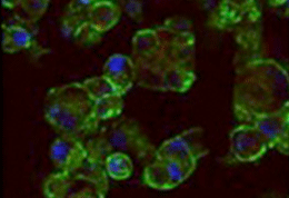 microscopic of murine pancreatic beta cells