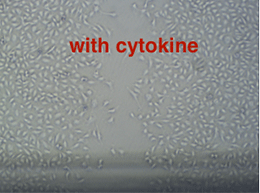 TPC-with-cytokines