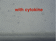 TPC with cytokines