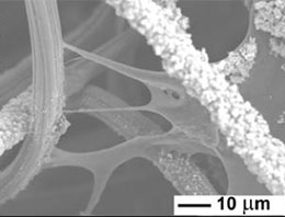 Grey scan showing a membrane supporting two vertical columns