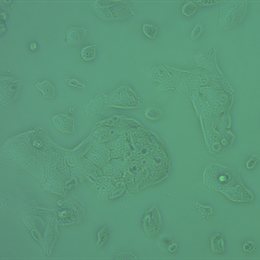 Hepatocytes-2