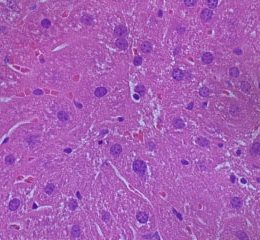 Normal-liver
