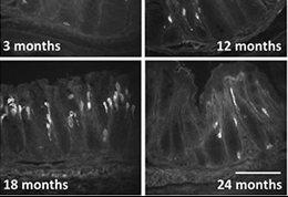 STRAND-Gi-tract-ageing