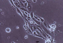 STRAND-Kidney-cells-AKI