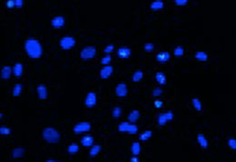 STRAND ageing cells