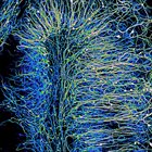 Combating disorders of CNS myelination