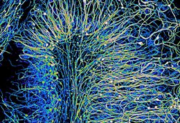 STRAND-combatting-CNS-myelination