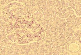 STRAND-pancreatic-islets-cellular-models-of-diabetes