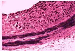 Localcardiovascular