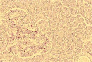 Image of cells under a microscope to illustrate STRAND What We Do page