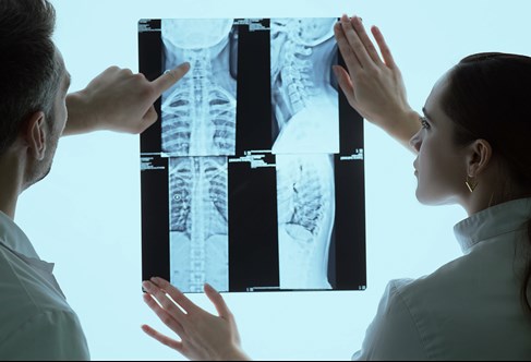 Two doctors discussing patients x-ray and MRI scans