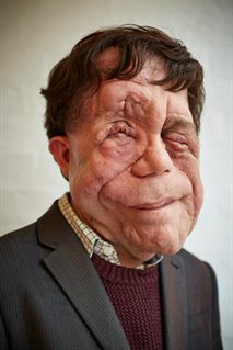 Adam Pearson (c) Mark Johnsonbetty 2015