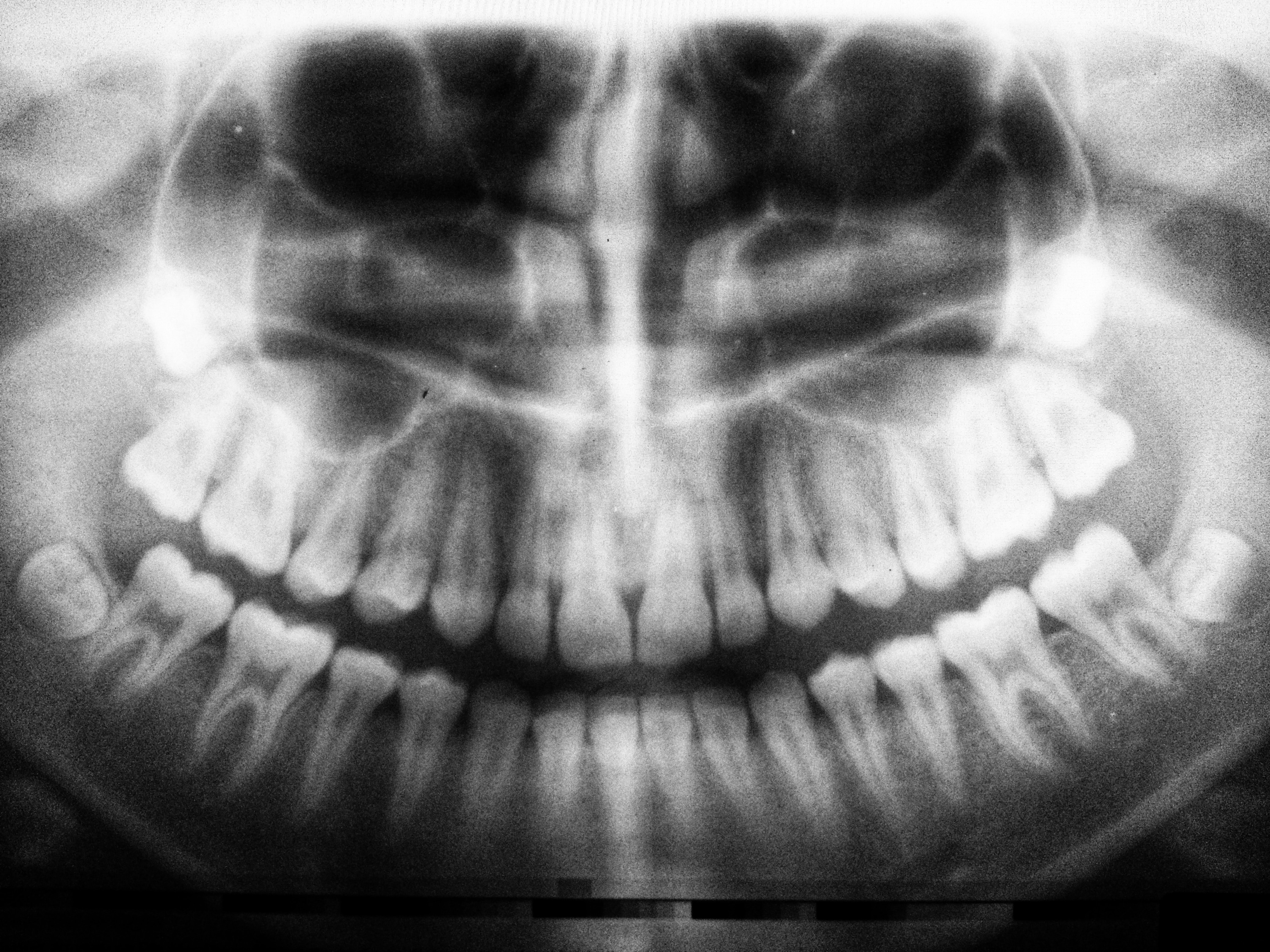 Dental x-ray photo by Umanoide on Unsplash