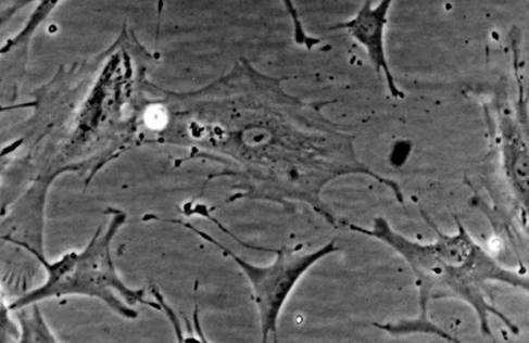 Phase-contrast-image-of-human-fibroblasts-2