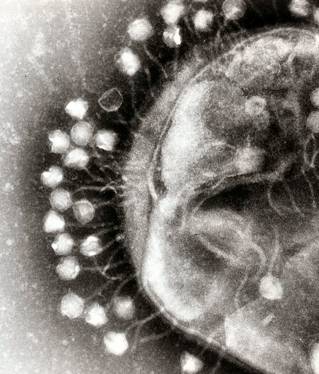 Phages attacking bacteria