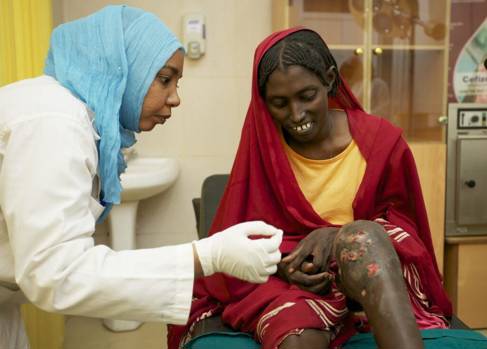 Treating mycetoma in Sudan - picture courtesy of Al-Fanar Media