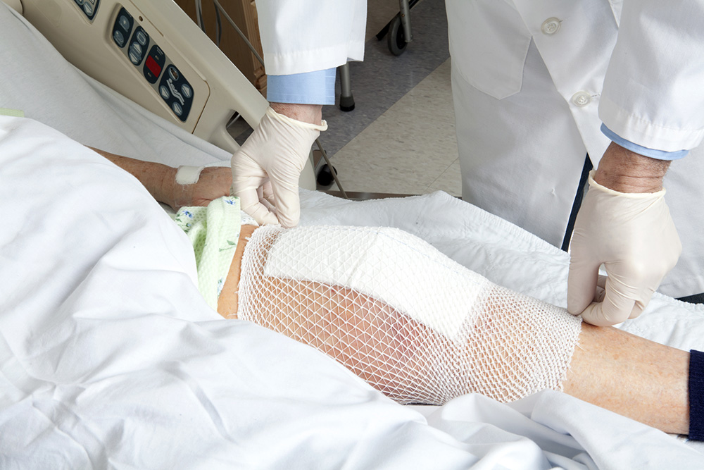 Leg wound and dressing