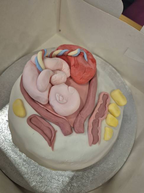 A cake decorated with a foetus and placenta made out of icing