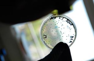 Close up of spots in a petri dish